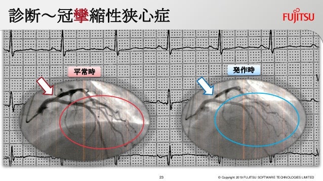 XP祭り2019 B-6 アジャイルソフトウェア開発への統計的品質管理の応用XP祭り2019 B-6 アジャイルソフトウェア開発への統計的品質管理の応用