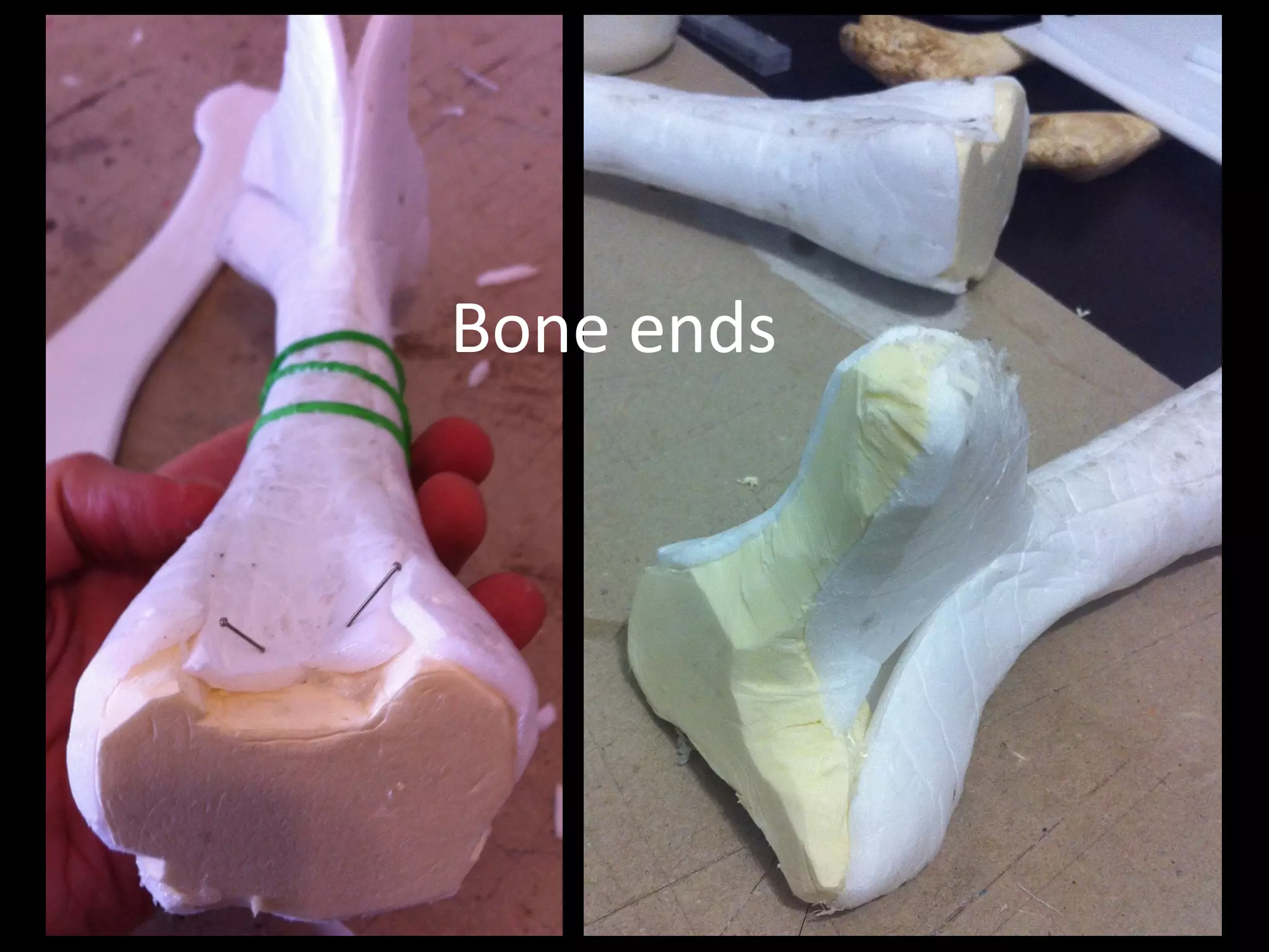 Bone	ends
 
