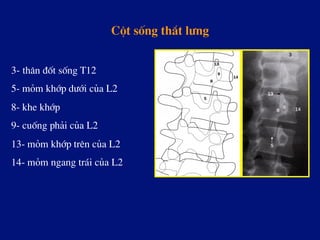 Cét sèng th¾t l­ng
3- th©n ®èt sèng T12
5- mám khíp d­íi cña L2
8- khe khíp
9- cuèng ph¶i cña L2
13- mám khíp trªn cña L2
14- mám ngang tr¸i cña L2
 