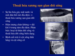 Tho¸i hãa x­¬ng sôn gian ®èt sèng
•  Sù l·o hãa g©y mÊt n­íc vµ
mÊt ®µn håi m« ®Üa ®Öm ->
tho¸i hãa x­¬ng sôn gian ®èt
sèng
•  HiÖn t­îng ch©n kh«ng = d¶i
khÝ ë trung t©m ®Üa ®Öm. Ph©n
biÖt: ho¹i tö th©n ®èt sèng vµ
tho¸i hãa ®èt sèng biÕn d¹ng.
•  BÖnh næi tréi ë cét sèng th¾t
l­ng vµ cét sèng cæ
 