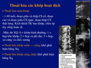 Tho¸i hãa c¸c khíp ho¹t dÞch
• Tho¸i hãa mÊu khíp
- > 60 tuæi, ®o¹n gi÷a vµ thÊp CS cæ, ®o¹n
cao vµ ®o¹n gi÷a CS ngùc, ®o¹n thÊp CS
th¾t l­ng. KÝch thÝch TK bao khíp, chÌn Ðp
tñy sèng hoÆc rÔ.
- Møc ®é XQ: 0 = khíp b×nh th­êng; 1 =
hÑp khe khíp; 2 = hÑp vµ ph× ®¹i; 3 = hÑp,
x¬ cøng vµ chåi x­¬ng
• Tho¸i hãa khíp s­ên – sèng: khã ph¸t
hiÖn b»ng Xq
• Tho¸i hãa khíp cïng chËu: khã ph¸t hiÖn
b»ng Xq
 