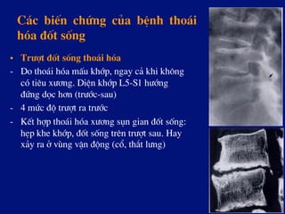 C¸c biÕn chøng cña bÖnh tho¸i
hãa ®èt sèng
•  Tr­ît ®èt sèng tho¸i hãa
-  Do tho¸i hãa mÊu khíp, ngay c¶ khi kh«ng
cã tiªu x­¬ng. DiÖn khíp L5-S1 h­íng
®øng däc h¬n (tr­íc-sau)
-  4 møc ®é tr­ît ra tr­íc
-  KÕt hîp tho¸i hãa x­¬ng sôn gian ®èt sèng:
hÑp khe khíp, ®èt sèng trªn tr­ît sau. Hay
x¶y ra ë vïng vËn ®éng (cæ, th¾t l­ng)
 