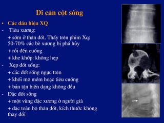 Di c¨n cét sèng
•  C¸c dÊu hiÖu XQ
-  Tiªu x­¬ng:
+ sím ë th©n ®èt. ThÊy trªn phim Xq:
50-70% c¸c bÌ x­¬ng bÞ ph¸ hñy
+ råi ®Õn cuèng
+ khe khíp: kh«ng hÑp
-  XÑp ®èt sèng:
+ c¸c ®èt sèng ngùc trªn
+ khèi m« mÒm hoÆc tiªu cuèng
+ b¶n tËn biÕn d¹ng kh«ng ®Òu
-  §Æc ®èt sèng
+ mét vïng ®Æc x­¬ng ë ng­êi giµ
+ ®Æc toµn bé th©n ®èt, kÝch th­íc kh«ng
thay ®æi
 