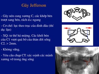 G·y Jefferson
- G·y nÐn cung x­¬ng C, c¸c khíp bªn
tr­ît sang bªn, r¸ch d.c ngang
- C¬ chÕ: lùc theo trôc cña ®Ønh ®Çu (thÝ
dô: lÆn)
- XQ: t­ thÕ h¸ miÖng. C¸c khèi bªn
cña C1 v­ît qu¸ bê cña th©n ®èt sèng
C2. > 2mm.
- Kh«ng v÷ng.
- Yªu cÇu chôp CT: x¸c ssÞnh c¸c m¶nh
x­¬ng vì trong èng sèng
 