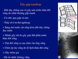 G·y gËp teardrop
- §øt d©y ch»ng sau vµ g·y nÐn tr­íc th©n ®èt
sèng do chÊn th­¬ng gÊp m¹nh
- C¬ chÕ: qua gÊp vµ nÐn
- ThÊy râ ë t­ thÕ nghiªng:
+ S­ng m« tr­íc cét sèng kÌm ®øt d©y ch»ng
däc tr­íc
+ M¶nh g·y rêi do g·y giËt ®øt phÇn tr­íc
th©n ®èt sèng
+ TrËt ®èt sèng ra sau chÌn vµo èng sèng
+ ChÌn Ðp tñy sèng do di lÖch th©n ®èt sèng
+ G·y mám gai
- §é æn ®Þnh: kh«ng v÷ng
 