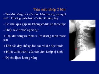 TrËt mÊu khíp 2 bªn
- TrËt ®èt sèng ra tr­íc do chÊn th­¬ng gËp qu¸
møc. Th­êng phèi hîp víi tæn th­¬ng tñy
- C¬ chÕ: qu¸ gÊp mµ kh«ng cã lùc Ðp theo trôc
- ThÊy râ ë t­ thÕ nghiªng:
+ TrËt ®èt sèng ra tr­íc > 1/2 ®­êng kÝnh tr­íc
sau
+ §øt c¸c d©y ch»ng däc sau vµ d.c däc tr­íc
+ H×nh c¸nh b­ím cña c¸c diÖn khíp bÞ khãa
- §é æn ®Þnh: kh«ng v÷ng
 