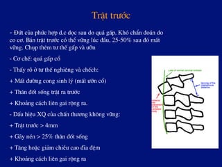 TrËt tr­íc
- §øt cña phøc hîp d.c däc sau do qu¸ gÊp. Khã chÈn ®o¸n do
co c¬. B¸n trËt tr­íc cã thÓ v÷ng lóc ®Çu, 25-50% sau ®ã mÊt
v÷ng. Chôp thªm t­ thÕ gÊp vµ ­ìn
- C¬ chÕ: qu¸ gÊp cæ
- ThÊy râ ë t­ thÕ nghiªng vµ chÕch:
+ MÊt ®­êng cong sinh lý (mÊt ­ìn cæ)
+ Th©n ®èt sèng trËt ra tr­íc
+ Kho¶ng c¸ch liªn gai réng ra.
- DÊu hiÖu XQ cña chÊn th­¬ng kh«ng v÷ng:
+ TrËt tr­íc > 4mm
+ G·y nÐn > 25% th©n ®èt sèng
+ T¨ng hoÆc gi¶m chiÒu cao ®Üa ®Öm
+ Kho¶ng c¸ch liªn gai réng ra
 