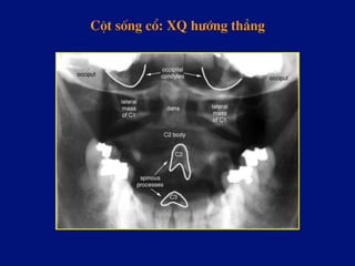 Cét sèng cæ: XQ h­íng th¼ng
 
