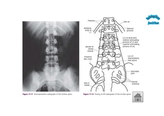 Spine Development Radiology Comprehensive Radiographic Analysis of the Human Spine: Embryology ...