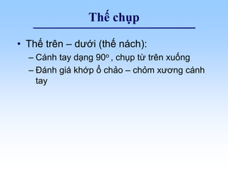 Thế chụp
• Thế trên – dưới (thế nách):
– Cánh tay dạng 90o , chụp từ trên xuống
– Đánh giá khớp ổ chảo – chỏm xương cánh
tay
 