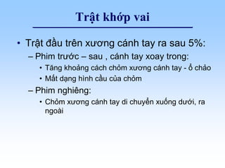 Trật khớp vai
• Trật đầu trên xương cánh tay ra sau 5%:
– Phim trước – sau , cánh tay xoay trong:
• Tăng khoảng cách chỏm xương cánh tay - ổ chảo
• Mất dạng hình cầu của chỏm
– Phim nghiêng:
• Chỏm xương cánh tay di chuyển xuống dưới, ra
ngoài
 