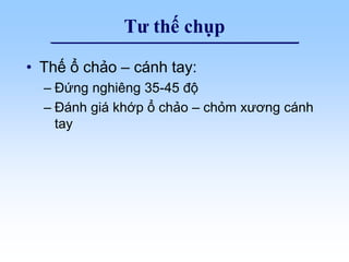 Tư thế chụp
• Thế ổ chảo – cánh tay:
– Đứng nghiêng 35-45 độ
– Đánh giá khớp ổ chảo – chỏm xương cánh
tay
 