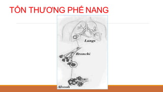 TỔN THƯƠNG PHẾ NANG
 