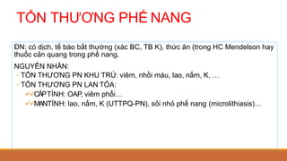 TỔN THƯƠNG PHẾ NANG
ĐN: có dịch, tế bào bất thường (xác BC, TB K), thức ăn (trong HC Mendelson hay
thuốc cản quang trong phế nang.
NGUYÊN NHÂN:
◦ TỔN THƯƠNG PN KHU TRÚ: viêm, nhồi máu, lao, nấm, K, …
◦ TỔN THƯƠNG PN LAN TỎA:
CẤPTÍNH: OAP, viêm phổi…
MẠNTÍNH: lao, nấm, K (UTTPQ-PN), sỏi nhỏ phế nang (microlithiasis)…
 