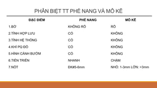 PHÂN BIỆT TT PHẾ NANG VÀ MÔ KẼ
 