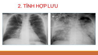 2. TÍNH HỢP LƯU
 