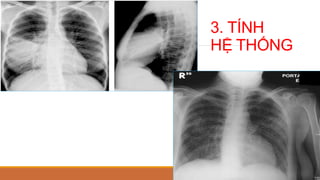 3. TÍNH
HỆ THỐNG
 