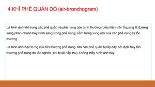 4.KHÍ PHẾ QUẢN ĐỒ (air-bronchogram)
Là hình ảnh khí trong các phế quản và phế nang còn bình thường (biểu hiện trên Xquang là đường
sáng phân nhánh hay hình sáng trong phế nang) nằm trong vùng mờ của các phế nang bị tổn
thương.
Là hình ảnh đặc trưng của tổn thương phế nang. Khi các phế quản bị lấp đầy bởi dịch hay tổn
thương phế nang do tắc nghẽn (khí bị tái hấp thu), không thấy hình ảnh này.
 