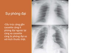 Sự phóng đại
-
‐Cấu trúc càng gần
cassette càng ít
phóng đại ngược lại
càng xa cassette
càng bị phóng đại so
với kích thước thật.
 