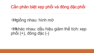 Cần phân biệt xẹp phổi và đông đặcphổi


giống nhau: hình mờ


khác nhau: dấu hiệu giảm thể tích: xẹp
phổi (+), đông đặc (-)
 