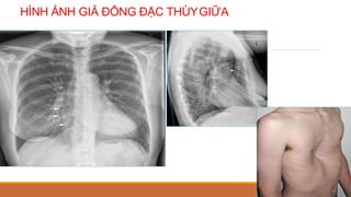 HÌNH ẢNH GIẢ ĐÔNG ĐẶC THÙYGIỮA
 