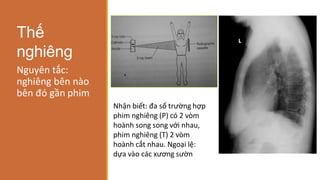 Thế
nghiêng
Nguyên tắc:
nghiêng bên nào
bên đó gần phim
Nhận biết: đa số trường hợp
phim nghiêng (P) có 2 vòm
hoành song song với nhau,
phim nghiêng (T) 2 vòm
hoành cắt nhau. Ngoại lệ:
dựa vào các xương sườn
 