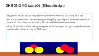 DH BÓNG MỜ (xóabờ) (Silhouette sign)
Nguyên lý: hai cấu trúc có cùng đậm độ dịch tiếp xúc nhau, bờ của chúng sẽ bị xóa
ĐN của B. Felson năm 1950: nếu bóng mờ trong lồng ngực tiếp xúc với bờ tim hay ĐMCN
sẽ xóa bờ của chúng, còn nếu không tiếp xúc sẽ không xóa bờ của chúng.
Dùng để xác định vị trí tổn thương trong phổi và tổn thương thuộc ngăn trung thất nào dựa
vào tính chất xóa bờ tim hay bờ ĐMC ngực
 