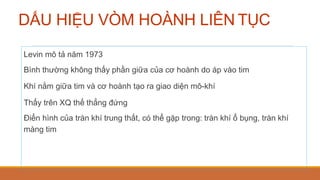 DẤU HIỆU VÒM HOÀNH LIÊN TỤC
Levin mô tả năm 1973
Bình thường không thấy phần giữa của cơ hoành do áp vào tim
Khí nằm giữa tim và cơ hoành tạo ra giao diện mô-khí
Thấy trên XQ thế thẳng đứng
Điển hình của tràn khí trung thất, có thể gặp trong: tràn khí ổ bụng, tràn khí
màng tim
 