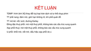 KẾT LUẬN
TDMP: hình ảnh XQ thay đổi tuỳ loại tràn dịch và tư thế chụp phim
TT phế nang: đám mờ, giới hạn không rõ, khí phế quản đồ
TT mô kẽ: nốt, lưới, đường Kerley
Đông đặc thuỳ phổi: mờ một thuỳ phổi, không kéo các cấu trúc xung quanh
Xẹp phổi thuỳ: mờ một thuỳ phổi, không kéo các cấu trúc xung quanh
U phổi: khối mờ, nốt mờ, dấu hiệu xẹp phổi do u
 