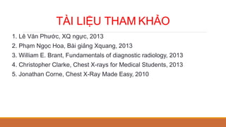 TÀI LIỆU THAM KHẢO
1. Lê Văn Phước, XQ ngực, 2013
2. Phạm Ngọc Hoa, Bài giảng Xquang, 2013
3. William E. Brant, Fundamentals of diagnostic radiology, 2013
4. Christopher Clarke, Chest X-rays for Medical Students, 2013
5. Jonathan Corne, Chest X-Ray Made Easy, 2010
 