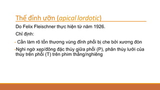 Thế đỉnh ưỡn (apicallordotic)
Do Felix Fleischner thực hiện từ năm 1926.
Chỉ định:
- Cần làm rõ tổn thương vùng đỉnh phổi bị che bởi xương đòn
-Nghi ngờ xẹp/đông đặc thùy giữa phổi (P), phân thùy lưỡi của
thùy trên phổi (T) trên phim thẳng/nghiêng
 