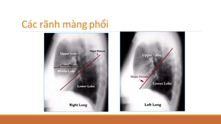 Các rãnh màng phổi
 