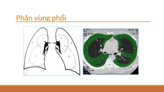 Phân vùng phổi
 
