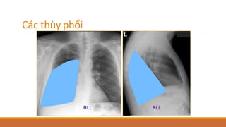 Các thùy phổi
 