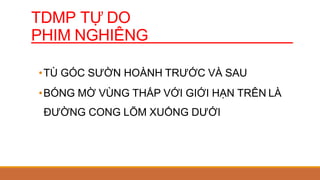 TDMP TỰ DO
PHIM NGHIÊNG
•TÙ GÓC SƯỜN HOÀNH TRƯỚC VÀ SAU
•BÓNG MỜ VÙNG THẤP VỚI GIỚI HẠN TRÊN LÀ
ĐƯỜNG CONG LÕM XUỐNG DƯỚI
 