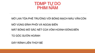 TDMP TỰ DO
PHIM NẰM
MỜ LAN TỎA PHẾ TRƯỜNG VỚI BÓNG MẠCH MÁU VẪN CÒN
MỜ VÙNG ĐỈNH PHỔI VÀ NGOẠI BIÊN
MẤT BÓNG MỜ SẮC NÉT CỦA VÒM HOÀNH ĐỒNG BÊN
TÙ GÓC SƯỜN HOÀNH
DÀY RÃNH LIÊN THÙY BÉ
 
