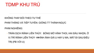 TDMP KHU TRÚ
KHÔNG THAY ĐỔI THEO TƯ THẾ
PHIM THẲNG VÀ TIẾP TUYẾN: GIỐNG TT THÀNH NGỰC
PHIM NGHIÊNG:
◦ TRÀN DỊCH RÃNH LIÊN THÙY: BÓNG MỜ HÌNH THOI, HAI ĐẦU NHỌN, Ở
VỊ TRÍ RÃNH LIÊN THÙY 

HÌNH ẢNH GIẢ U HAY U MA, MẤT ĐI SAU ĐIỀU
TRỊ (PB VỚI U)
 