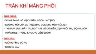 TRÀN KHÍ MÀNG PHỔI
• PHIM ĐỨNG:
• VÙNG SÁNG VÔ MẠCH NẰM NGOÀI LÁ TẠNG
• ĐƯỜNG MỜ CỦA LÁ TẠNG BAO BỌC NHU MÔ PHỔI XẸP
• TKMP ÁP LỰC: ĐẨY TRUNG THẤT VỀ ĐỐI BÊN, XẸP PHỔI THỤ ĐỘNG,VÒM
HOÀNH DẸT, RỘNG KHOẢNG LIÊN SƯỜN
• PHIM NẰM:
• GIỐNG PHIM ĐỨNG
• DH KHE SÂU
 