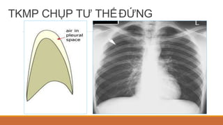 TKMP CHỤP TƯ THẾĐỨNG
 