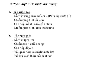 Phaân bieät möùc nöôùc hôi trong:
1. Taéc ruoät non:
- Naèm ôû trung taâm: hoá chaäu (P)  haï söôøn (T)
- Chieàu roäng > chieàu cao
- Caùc neáp maûnh, naèm gaàn nhau
- Nhieàu quai ruoät, kích thöôùc nhoû
2. Taéc ruoät giaø:
- Naèm ôû ngoaïi vi
- Chieàu cao > chieàu roäng
- Caùc neáp daøy, ít
- Vaøi quai ruoät voùi kích thöôùc lôùn
- Veà sau keøm theâm taéc ruoät non
 
