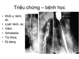 Triệu chứng – bệnh học
• Khối u: lành,
ác
• Loét: lành, ác
• Viêm
• Achalasia
• Túi thừa
• Dị dạng
 
