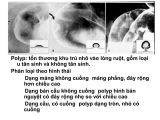 Polyp: tổn thương khu trú nhô vào lòng ruột, gồm loại
u tân sinh và không tân sinh.
Phân loại theo hình thái
Dạng mảng không cuống mảng phẳng, đáy rộng
hơn chiều cao
Dạng bán cầu không cuống polyp hình bán
nguyệt có đáy rộng nhẹ so với chiều cao
Dạng cầu, có cuống polyp dạng tròn, nhỏ có
cuống
 