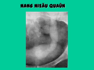 NANG NIEÄU QUAÛN

 