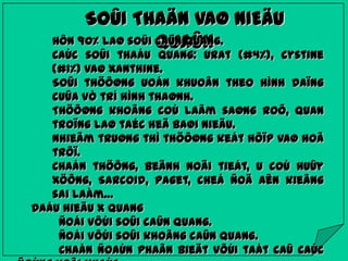 SOÛI THAÄN VAØ NIEÄU
Hôn 90% laø soûi caûn quang.
QUAÛN

Caùc soûi thaáu quang: urat (#4%), cystine
(#1%) vaø xanthine.
Soûi thöôøng uoán khuoân theo hình daïng
cuûa vò trí hình thaønh.
Thöôøng khoâng coù laâm saøng roõ, quan
troïng laø taéc heä baøi nieäu.
Nhieãm truøng thì thöôøng keát hôïp vaø hoã
trôï.
Chaán thöông, beänh noäi tieát, u coù huûy
xöông, Sarcoid, Paget, cheá ñoä aên kieâng
sai laàm…
Daáu hieäu X quang
Ñoái vôùi soûi caûn quang.
Ñoái vôùi soûi khoâng caûn quang.
Chaån ñoaùn phaân bieät vôùi taát caû caùc

 