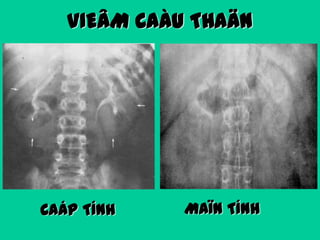VIEÂM CAÀU THAÄN

CAÁP TÍNH

MAÏN TÍNH

 