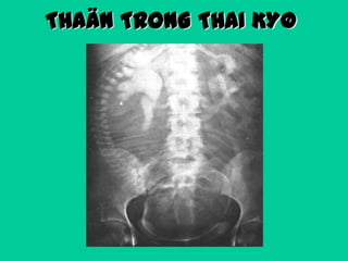 THAÄN TRONG THAI KYØ

 