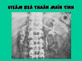 VIEÂM BEÅ THAÄN MAÏN TÍNH

 