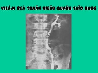 VIEÂM BEÅ THAÄN NIEÄU QUAÛN TAÏO NANG

 