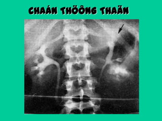 CHAÁN THÖÔNG THAÄN

 