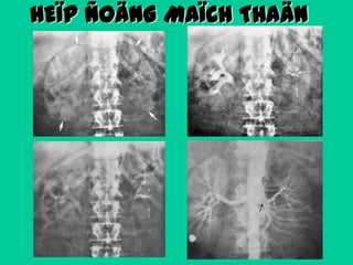 HEÏP ÑOÄNG MAÏCH THAÄN

 